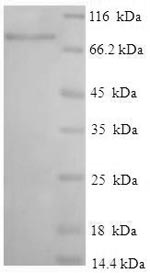 Recombinant Human Interferon-induced protein with tetratricopeptide repeats 3 (IFIT3) – Figure 1 of 1