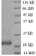 Recombinant Human Interferon alpha-10 (IFNA10) – Figure 1 of 1