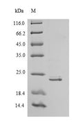 Recombinant Human Interferon alpha-21 (IFNA21) – Figure 1 of 1
