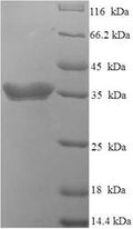 Recombinant Human Interferon alpha-4 (IFNA4), partial – Figure 1 of 1