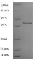 Recombinant Human Interferon alpha/beta receptor 2 (IFNAR2), partial – Figure 1 of 1