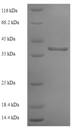 Recombinant Human Interferon alpha/beta receptor 2 (IFNAR2), partial – Figure 1 of 1