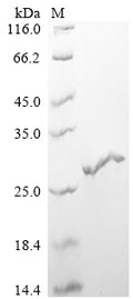 (Tris-Glycine gel) Discontinuous SDS-PAGE (reduced) with 5% enrichment gel and 15% separation gel.
