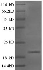 Recombinant Sheep Interferon gamma (IFNG) – Figure 1 of 1