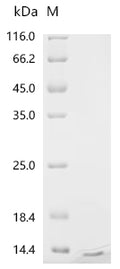 (Tris-Glycine gel) Discontinuous SDS-PAGE (reduced) with 5% enrichment gel and 15% separation gel.