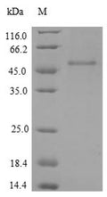 Recombinant Human Insulin-like growth factor 1 receptor (IGF1R), partial – Figure 1 of 1