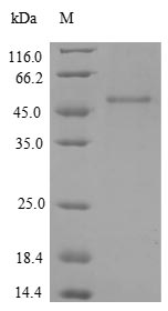Recombinant Human Insulin-like growth factor 1 receptor (IGF1R), partial – Figure 1 of 1