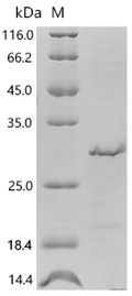 (Tris-Glycine gel) Discontinuous SDS-PAGE (reduced) with 5% enrichment gel and 15% separation gel.