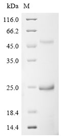 (Tris-Glycine gel) Discontinuous SDS-PAGE (reduced) with 5% enrichment gel and 15% separation gel.