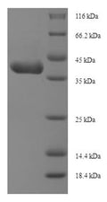 Recombinant Mouse Insulin-like growth factor-binding protein 1 (Igfbp1) – Figure 1 of 1