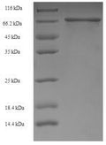 Recombinant Human Ig gamma-1 chain C region (IGHG1) – Figure 1 of 1