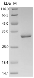 (Tris-Glycine gel) Discontinuous SDS-PAGE (reduced) with 5% enrichment gel and 15% separation gel.