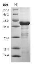 Recombinant Rabbit Interleukin 17A (IL17A), partial – Figure 1 of 1