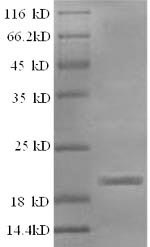 Recombinant Sheep Interleukin-1 beta (IL1B) – Figure 1 of 1