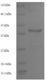 Recombinant Human Interleukin-2 (IL2) – Figure 1 of 1
