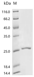 (Tris-Glycine gel) Discontinuous SDS-PAGE (reduced) with 5% enrichment gel and 15% separation gel.