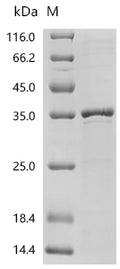 (Tris-Glycine gel) Discontinuous SDS-PAGE (reduced) with 5% enrichment gel and 15% separation gel.