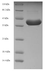 Recombinant Human Interleukin-3 (IL3) – Figure 1 of 1