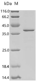 (Tris-Glycine gel) Discontinuous SDS-PAGE (reduced) with 5% enrichment gel and 15% separation gel.
