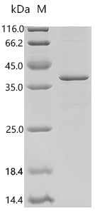 (Tris-Glycine gel) Discontinuous SDS-PAGE (reduced) with 5% enrichment gel and 15% separation gel.