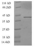 Recombinant Pig Interleukin-33 (IL33), partial – Figure 1 of 1