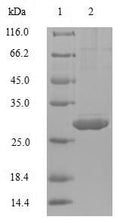 (Tris-Glycine gel) Discontinuous SDS-PAGE (reduced) with 5% enrichment gel and 15% separation gel.