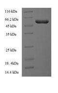 Recombinant Human Integrin-linked kinase-associated serine/threonine phosphatase 2C (ILKAP) – Figure 1 of 1
