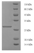 Recombinant Human Inhibin beta A chain (INHBA) – Figure 1 of 1