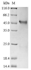 (Tris-Glycine gel) Discontinuous SDS-PAGE (reduced) with 5% enrichment gel and 15% separation gel.