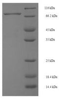 Recombinant Mouse Interferon regulatory factor 5 (Irf5) – Figure 1 of 1