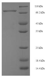 Recombinant Mouse Interferon regulatory factor 5 (Irf5) – Figure 1 of 1