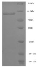 Recombinant Mouse Interferon regulatory factor 8 (Irf8) – Figure 1 of 1