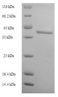 Recombinant Human Intestine-specific homeobox (ISX) – Figure 1 of 1