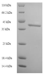 Recombinant Human Intestine-specific homeobox (ISX) – Figure 1 of 1