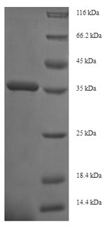Recombinant Human Integrin alpha-2 (ITGA2), partial – Figure 1 of 1