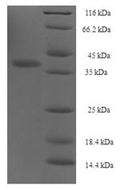 Recombinant Human Integrin alpha-IIb (ITGA2B), partial – Figure 1 of 1