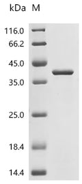 (Tris-Glycine gel) Discontinuous SDS-PAGE (reduced) with 5% enrichment gel and 15% separation gel.