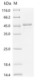 (Tris-Glycine gel) Discontinuous SDS-PAGE (reduced) with 5% enrichment gel and 15% separation gel.