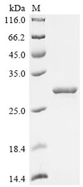 (Tris-Glycine gel) Discontinuous SDS-PAGE (reduced) with 5% enrichment gel and 15% separation gel.