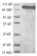 Recombinant Rat Integrin beta-1 (Itgb1), partial – Figure 1 of 1