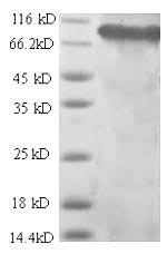 Recombinant Rat Integrin beta-1 (Itgb1), partial – Figure 1 of 1