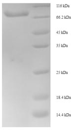 Recombinant Human Inositol-trisphosphate 3-kinase B (ITPKB), partial – Figure 1 of 1