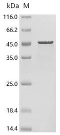 (Tris-Glycine gel) Discontinuous SDS-PAGE (reduced) with 5% enrichment gel and 15% separation gel.