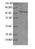 Recombinant Human Tyrosine-protein kinase JAK2 (JAK2), partial – Figure 1 of 1