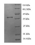 Recombinant Human JmjC domain-containing protein 7 (JMJD7) – Figure 1 of 1
