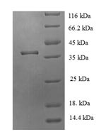 Recombinant Human JmjC domain-containing protein 7 (JMJD7) – Figure 1 of 1