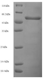 Recombinant Human Voltage-gated potassium channel subunit beta-2 (KCNAB2) – Figure 1 of 1
