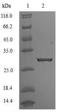 (Tris-Glycine gel) Discontinuous SDS-PAGE (reduced) with 5% enrichment gel and 15% separation gel.