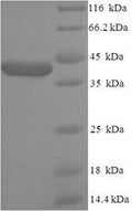 (Tris-Glycine gel) Discontinuous SDS-PAGE (reduced) with 5% enrichment gel and 15% separation gel.