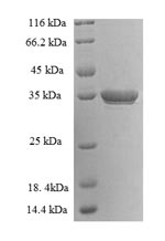 Recombinant Human Lysine-specific demethylase 5A (KDM5A), partial – Figure 1 of 1